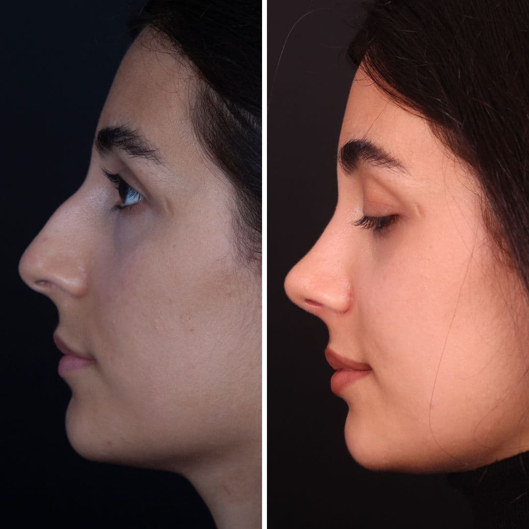 Əməliyyat əvvəli və sonrası