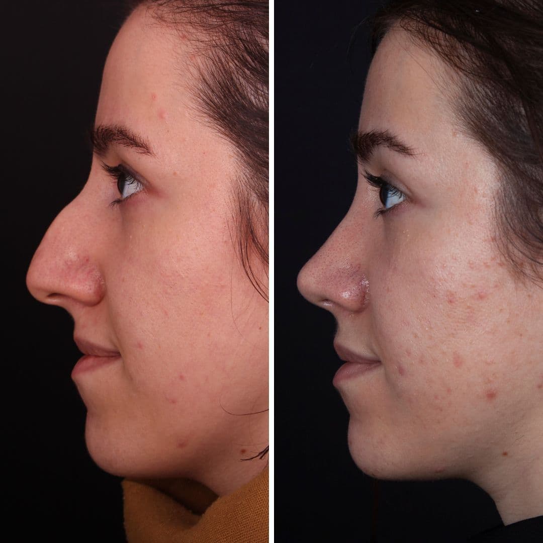 Əməliyyat əvvəli və sonrası