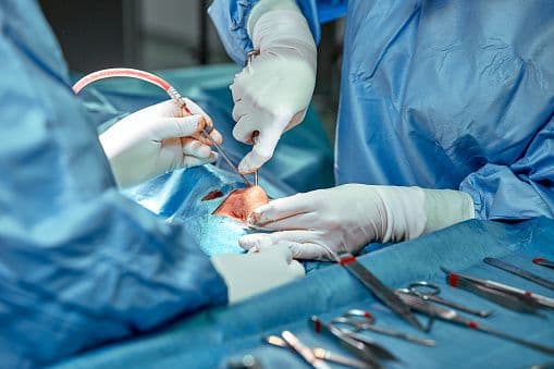 Müasir rinoplastika necə icra olunur?